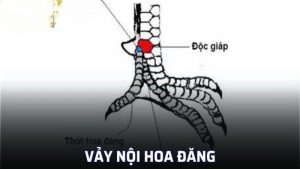 Vảy nội hoa đăng là gì?